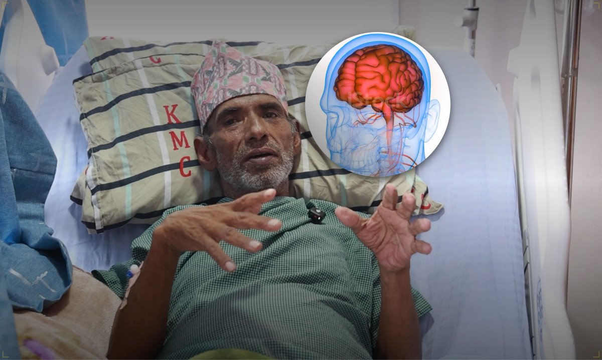 KMC Successfully Treats Complex Brain Hemorrhage Using Neurointervention