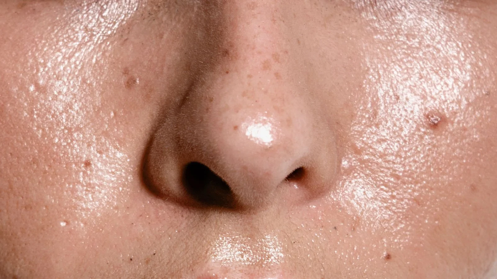 6-tips-for-keeping-oily-skin-at-bay-492855_7656ea59-3917-4f58-960c-b77c8d7beca3.jpg