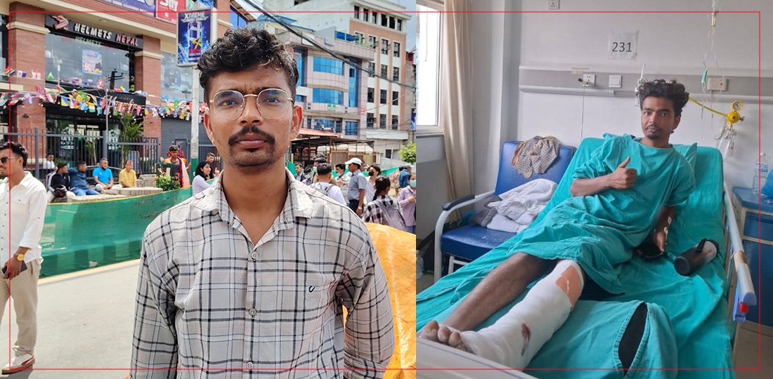 खुट्टामा गोली लागेका जेनजी आनन्द भन्छन्ः सरकारले हामीलाई बिदेसिन बाध्य बनायो