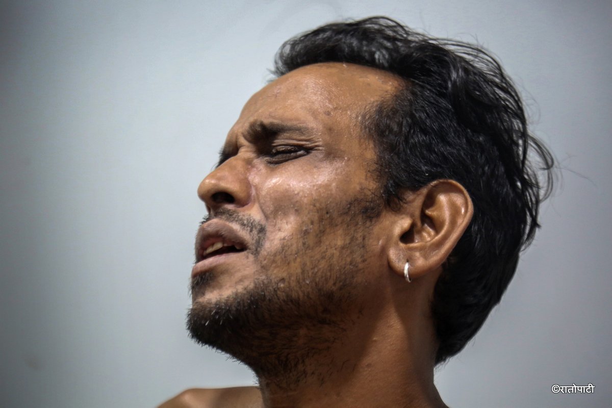 Anil Pariyar_Injured by bullet durring_Gen Z protest_Baluwater_NPL (13)