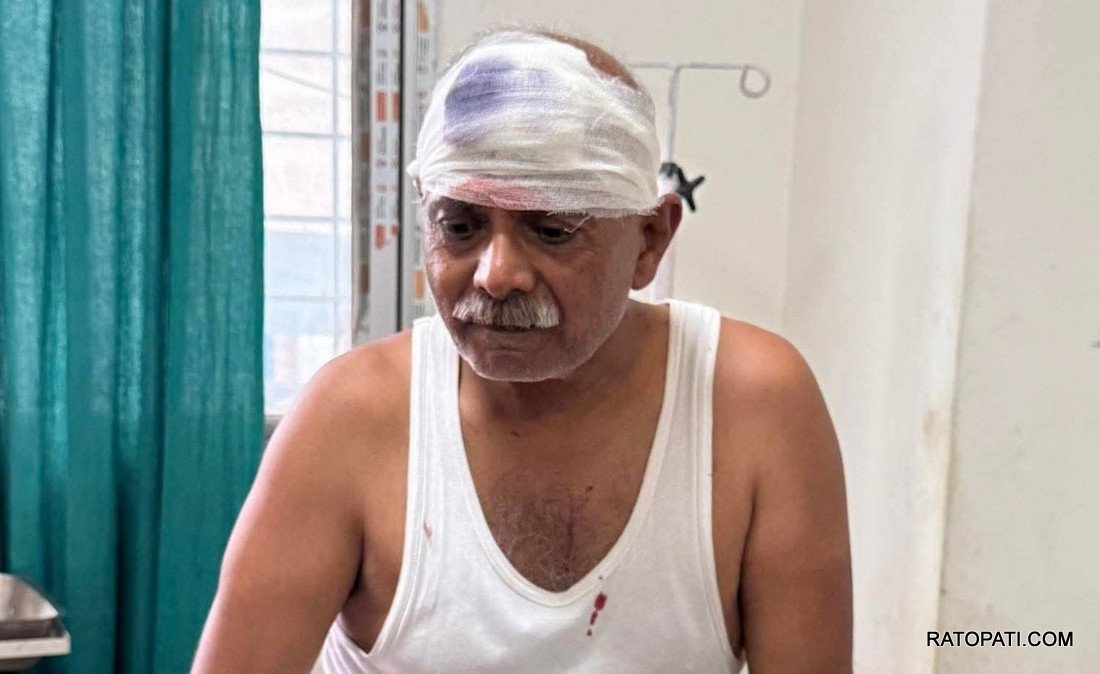 bindal das