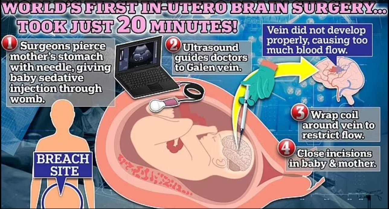 brain surgery