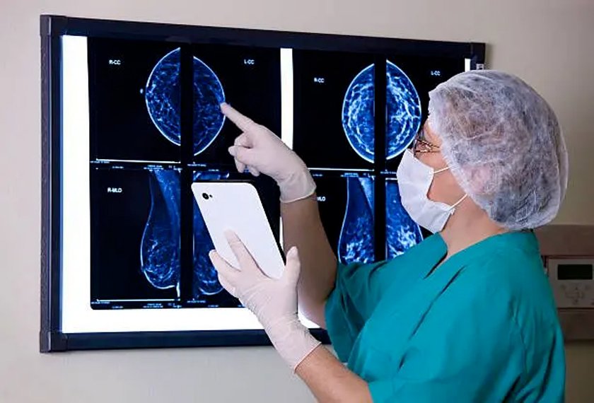 breast-cancer-2