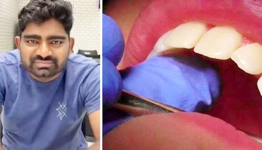 बिहेअघि दाँतको सर्जरी गर्न गएका २८ वर्षीय युवकको मृत्यु