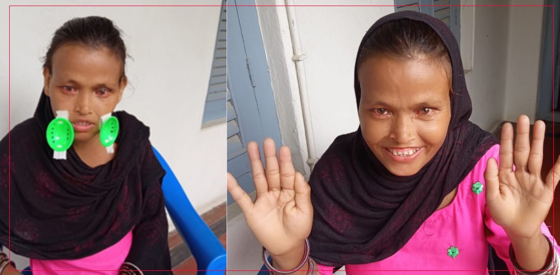 आँखाको ज्योति फर्किएपछि चन्द्रावती : ‘अब  संसारसँग छामेर होइन, हेरेर आफैँ जुध्न सक्छु’