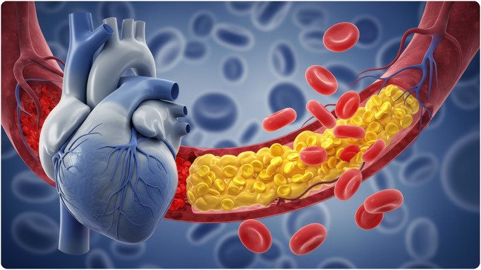 cholesterol-heart_db64e90c99f0cb959950cb4e2f7dc09d