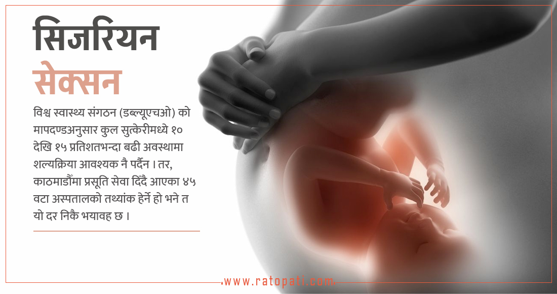बढ्दो शल्यक्रिया : प्राकृतिक जन्ममा बाधा