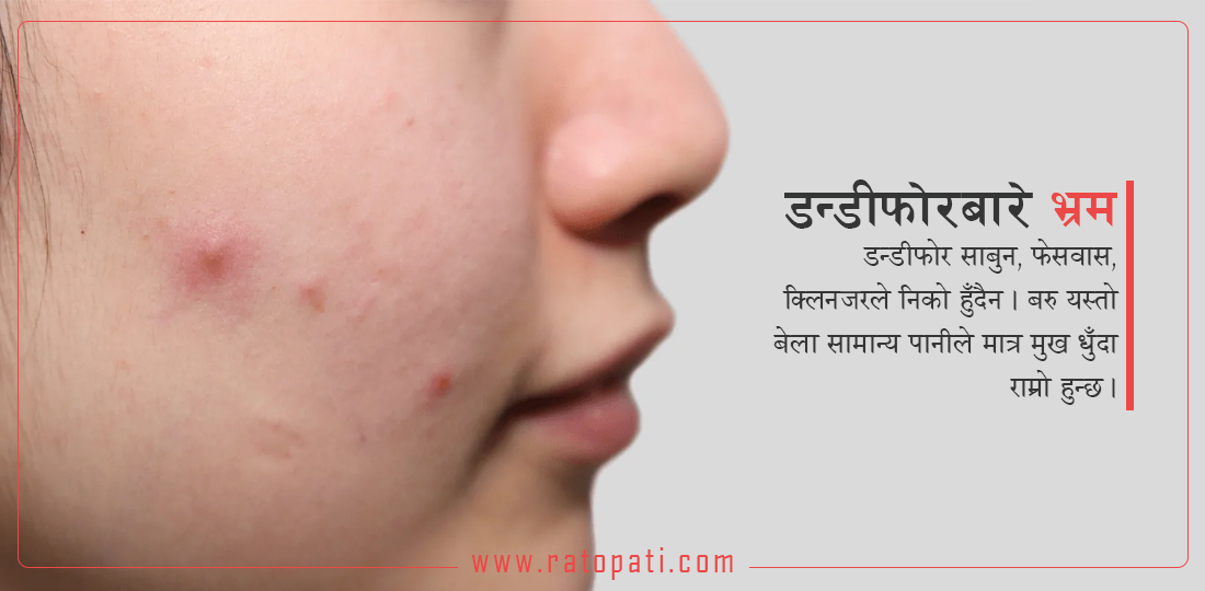   २५ वर्ष कटिसकेपछि आउने डन्डिफोर सामान्य होइन