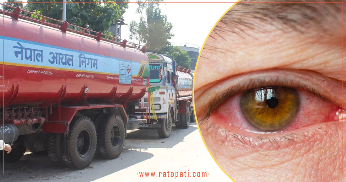 आँखाको समस्या बोकेरै गाडी चलाउँछन् ट्याङ्कर चालक, दुर्घटनाको जोखिम
