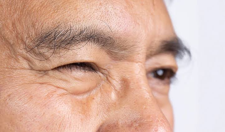 Eye Twitching: Causes, Symptoms, and When to Seek Medical Advice