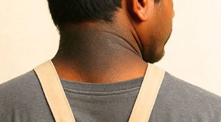 गर्धन किन कालो देखिन्छ  ?