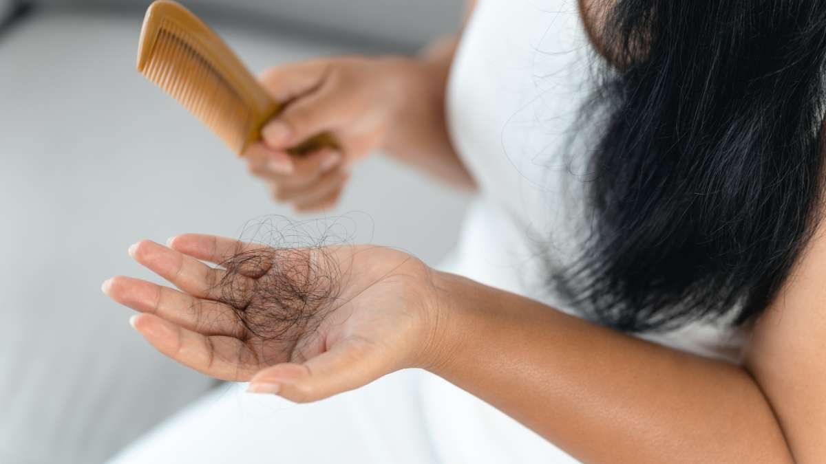 Hair-fall