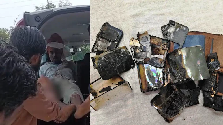 Youth Injured in Mobile Phone Explosion in Madhya Pradesh