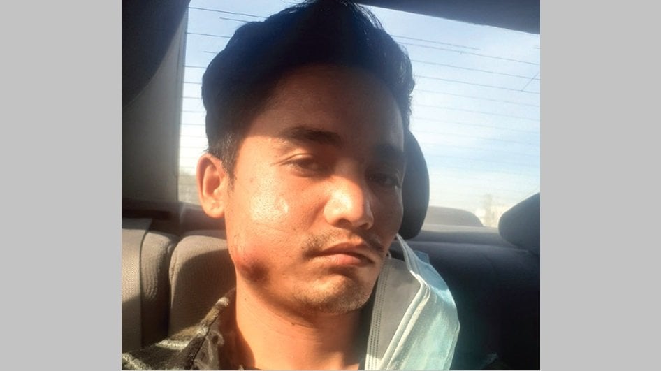 यूएईमा नेपाली बिरामी हुँदा उपचारै गर्दैनन् रोजगारदाता