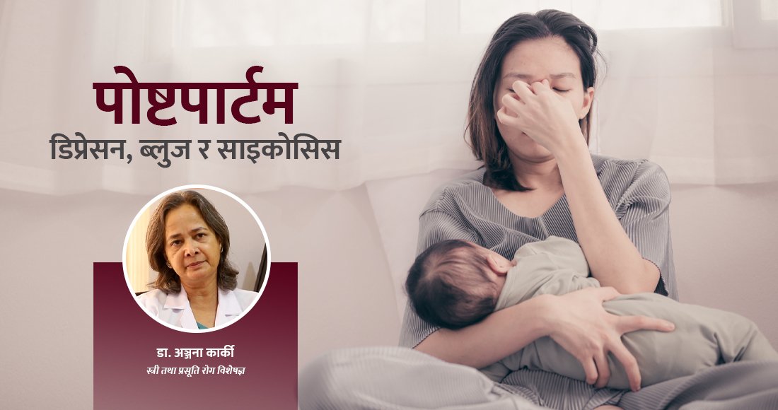   सुत्केरी महिलामा हुने पोष्टपार्टम डिप्रेसन, ब्लुज र साइकोसिस के हो ?