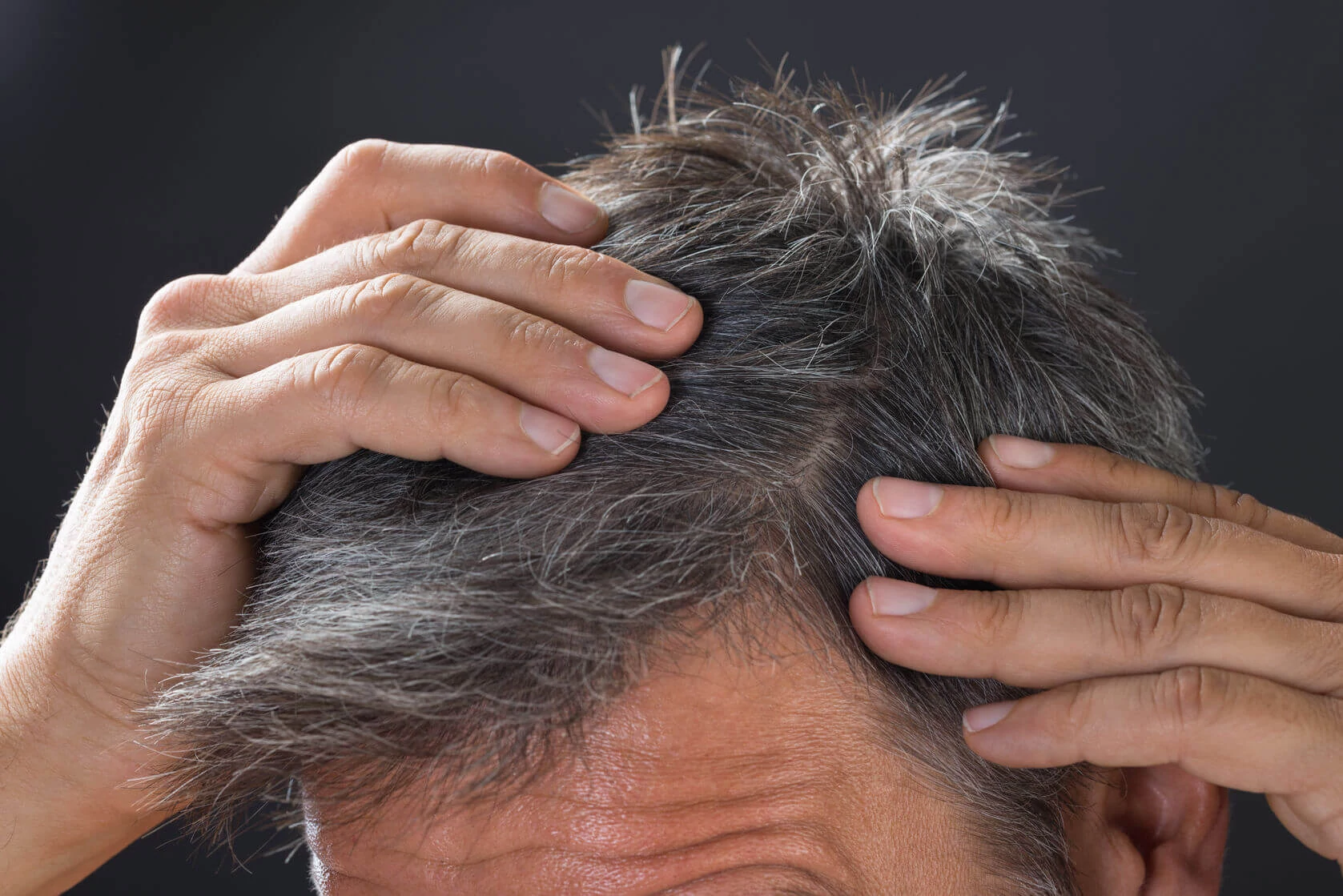 Premature-Grey-Hair-Treatment-Why-Is-Your-Hair-Losing-Its-Luster