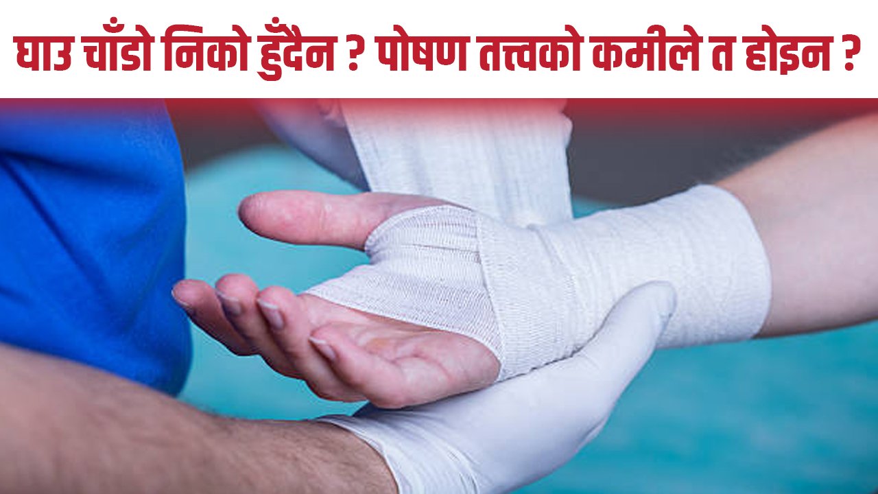 तपाईँको शरीरमा पोषक तत्त्वको कमी छ ?