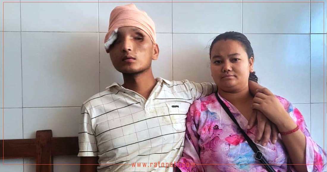   क्रोएसिया जाने तयारीमा रहेका सन्तोषले दुवै आँखा गुमाए