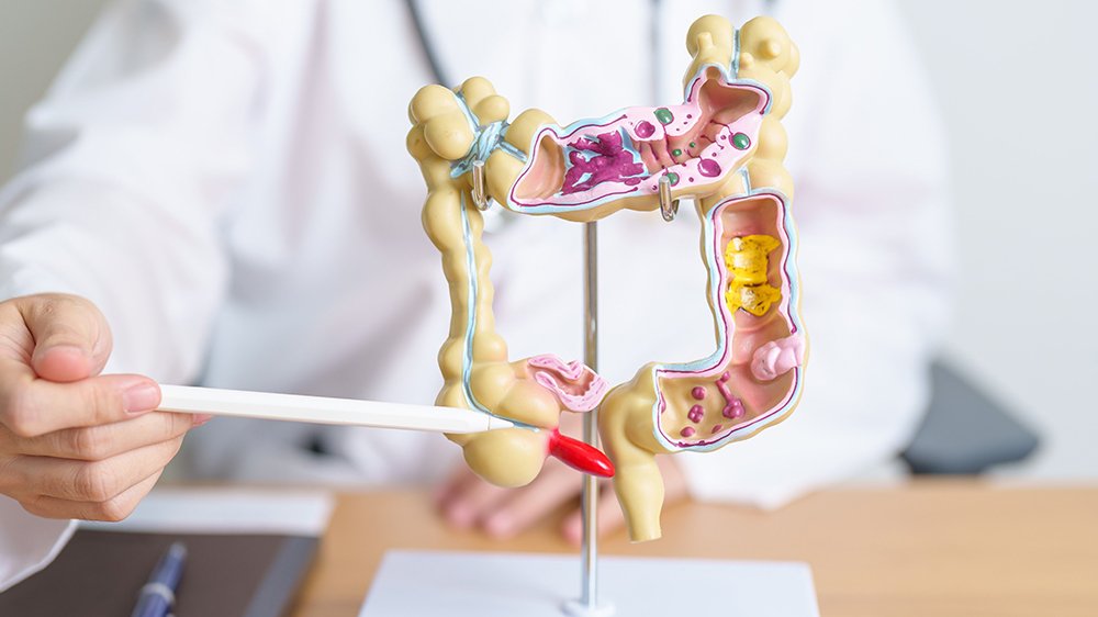 Stages_of_Appendicitis_8047dd7a26