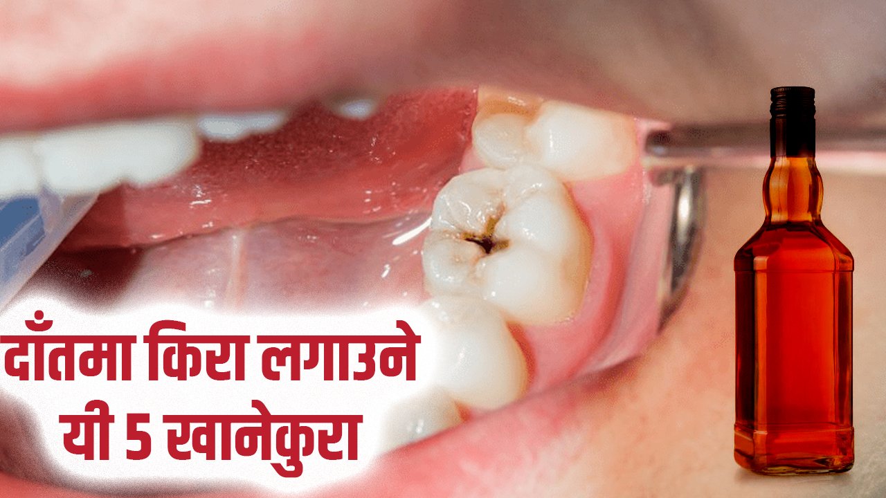 दाँतमा किरा लगाउने यी ५ खानेकुरा