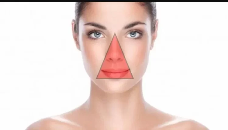 Triangle-of-Death-pimple3-750x429
